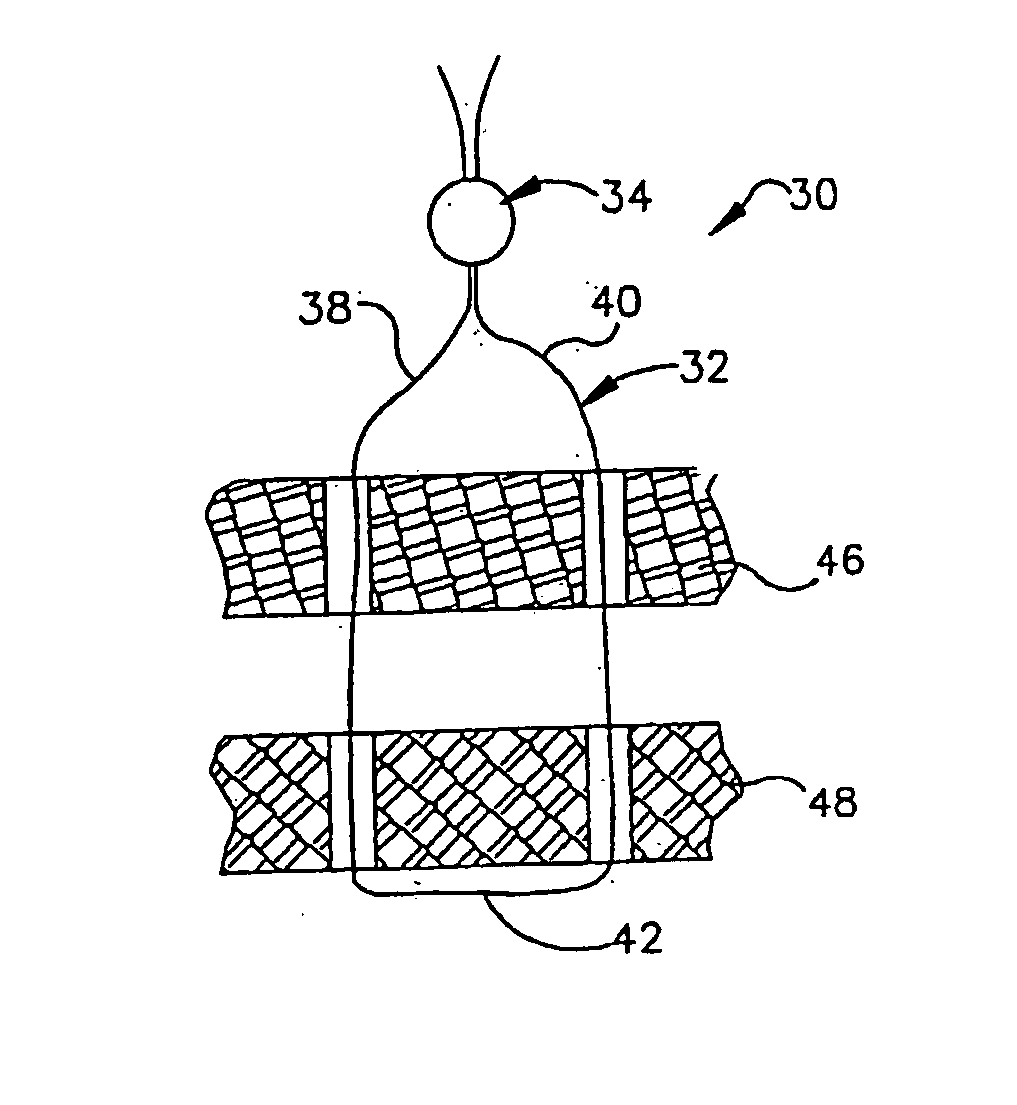 Method of using ultrasonic vibration to secure body tissue