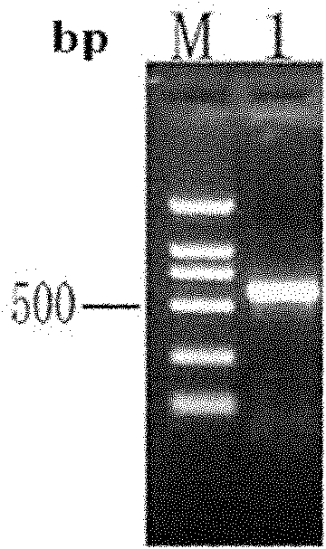 Fusion expression product of antimicrobial peptide genes of two marine animals and preparation method of fusion expression product