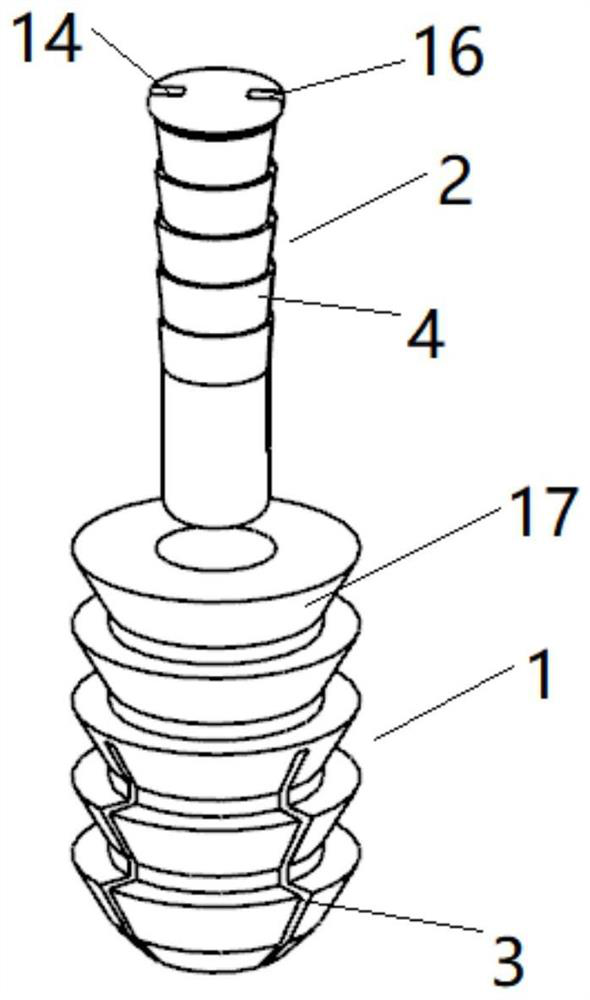 Extrusion type expansion anchor