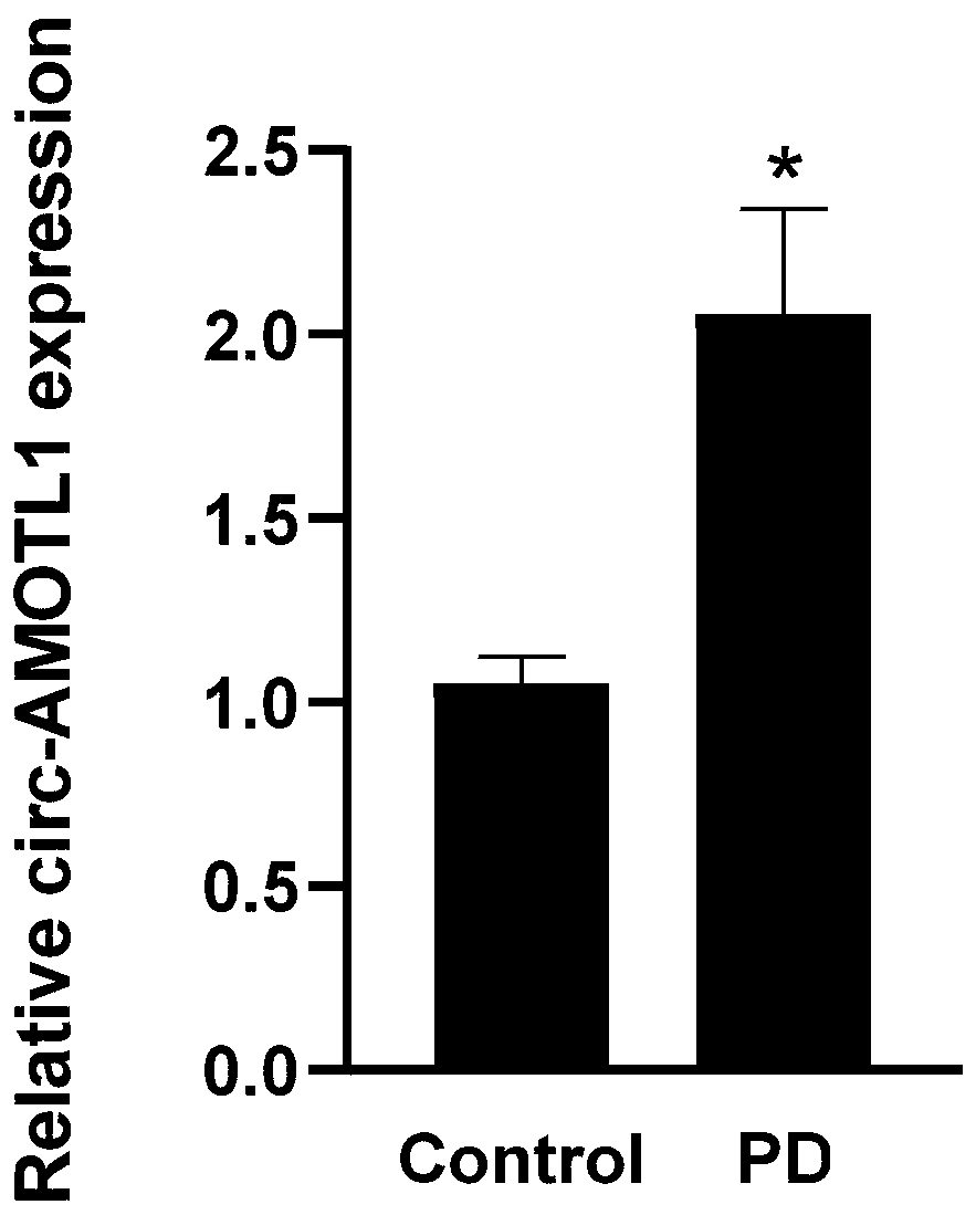 Parkinson's disease biomarker and application thereof