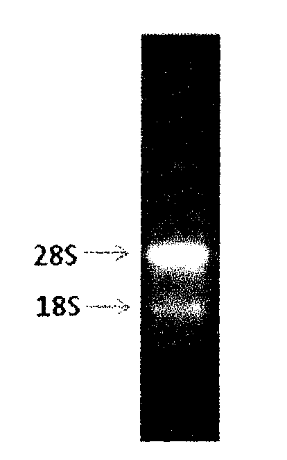 Enzyme-linked immune sorbent assay (ELISA) kit for detecting Shiga toxin II (StxII)