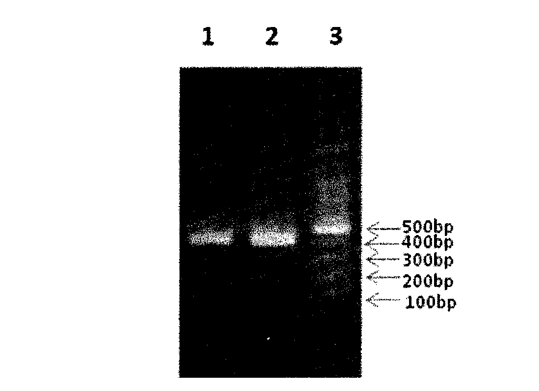 Enzyme-linked immune sorbent assay (ELISA) kit for detecting Shiga toxin II (StxII)