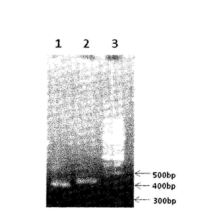 Enzyme-linked immune sorbent assay (ELISA) kit for detecting Shiga toxin II (StxII)