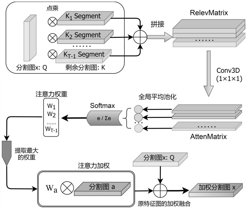 Brain tumor detection method based on attention mechanism and MRI (Magnetic Resonance Imaging) multi-modal fusion