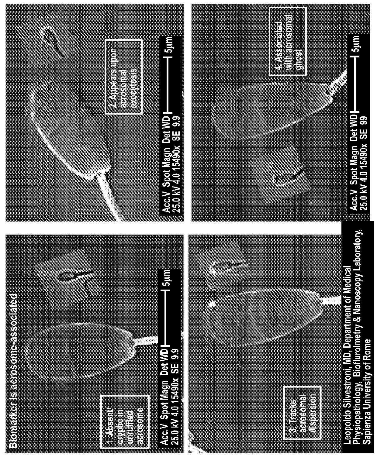 Rapid real time multipoint procedure for optimizing sperm state for use in assisted reproductive technologies