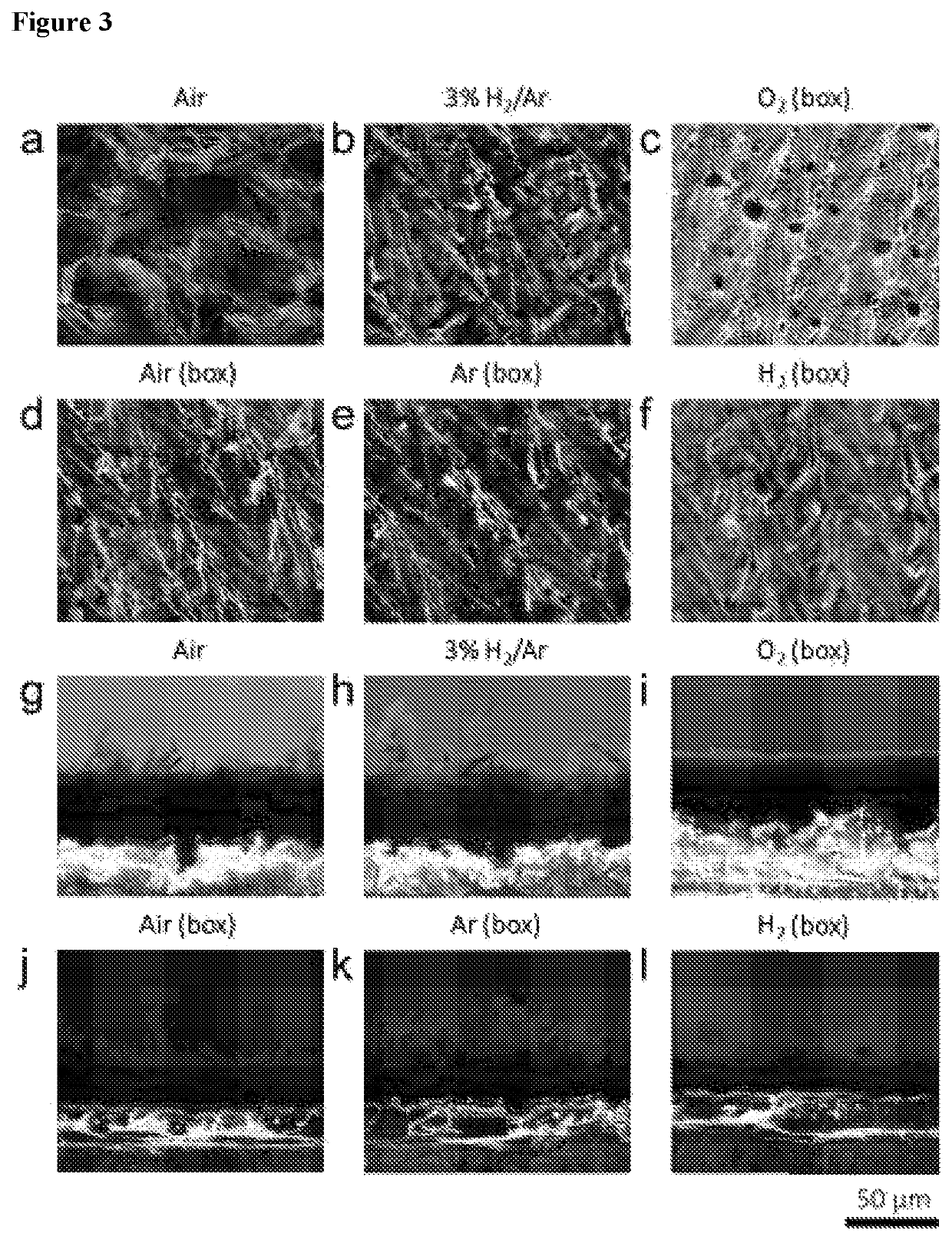 Antibiofilm and antimicrobial functional membrane spacer