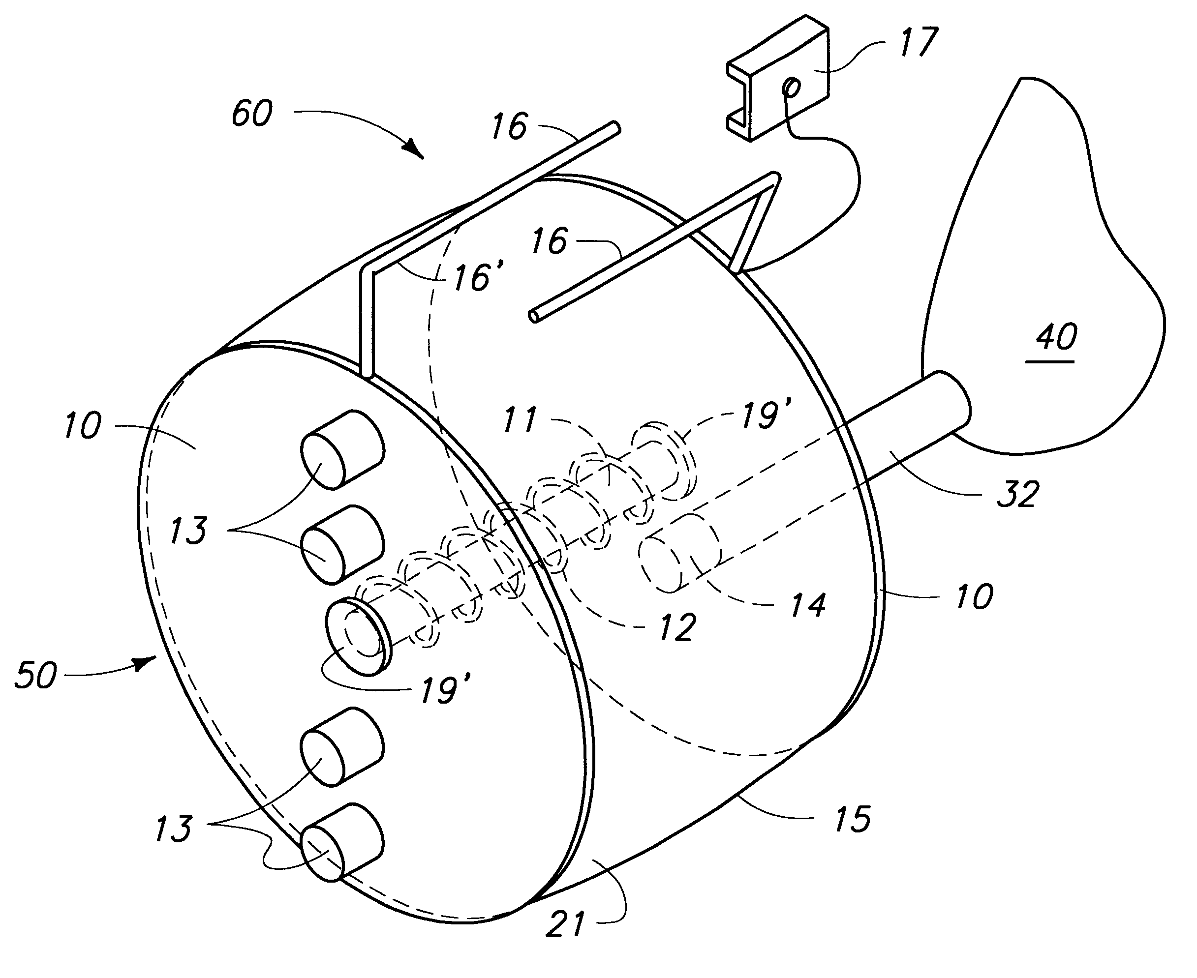 Manual pump and Ambu bag