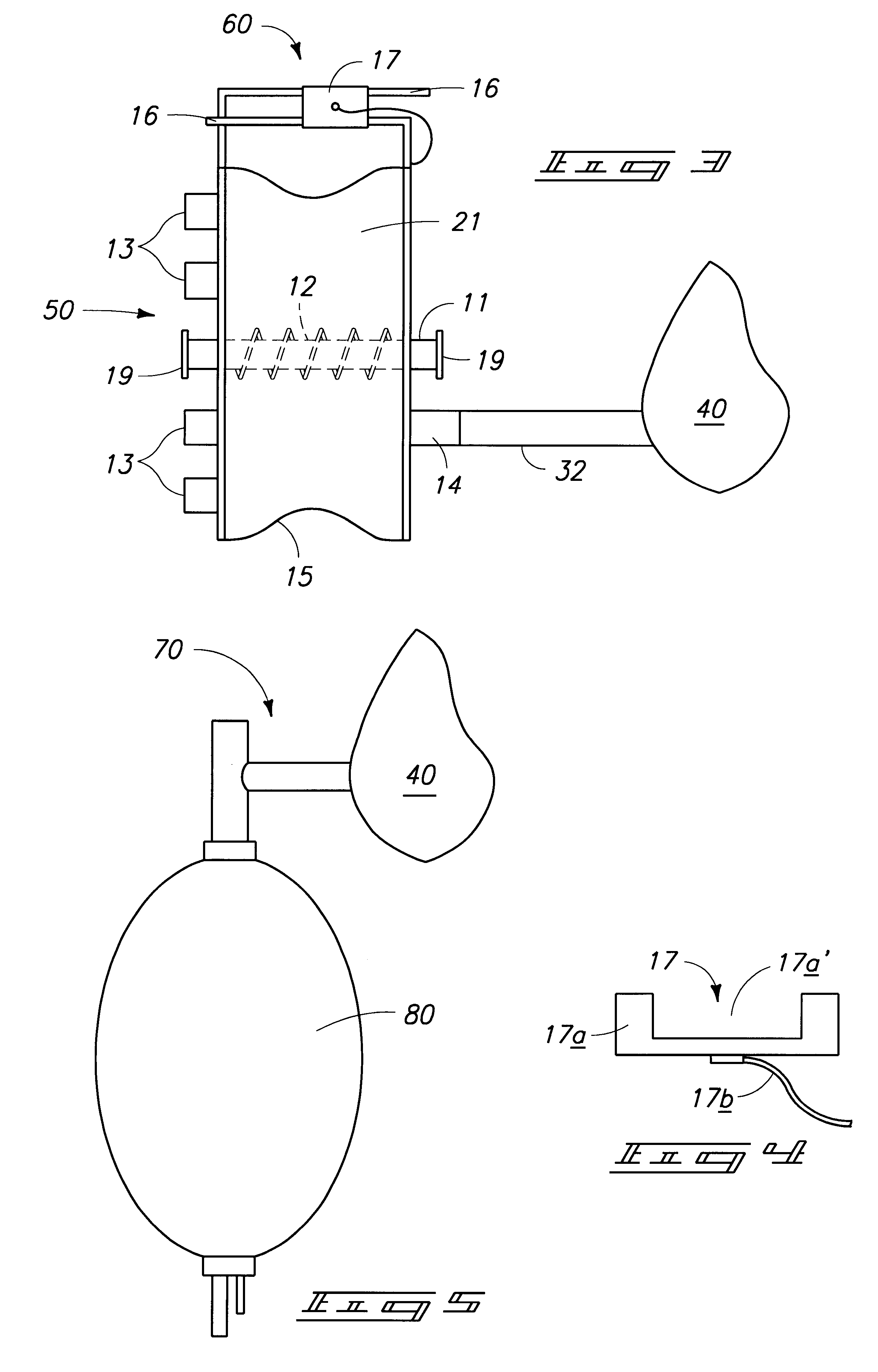 Manual pump and Ambu bag