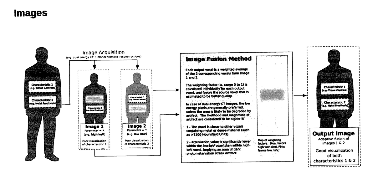 Method for Reduction of Artifacts and Preservation of Soft Tissue Contrast and Conspicuity of Iodinated Materials on Computed Tomography Images by means of Adaptive Fusion of Input Images Obtained from Dual-Energy CT Scans, and Use of differences in Voxel intensities between high and low-energy images in estimation of artifact magnitude