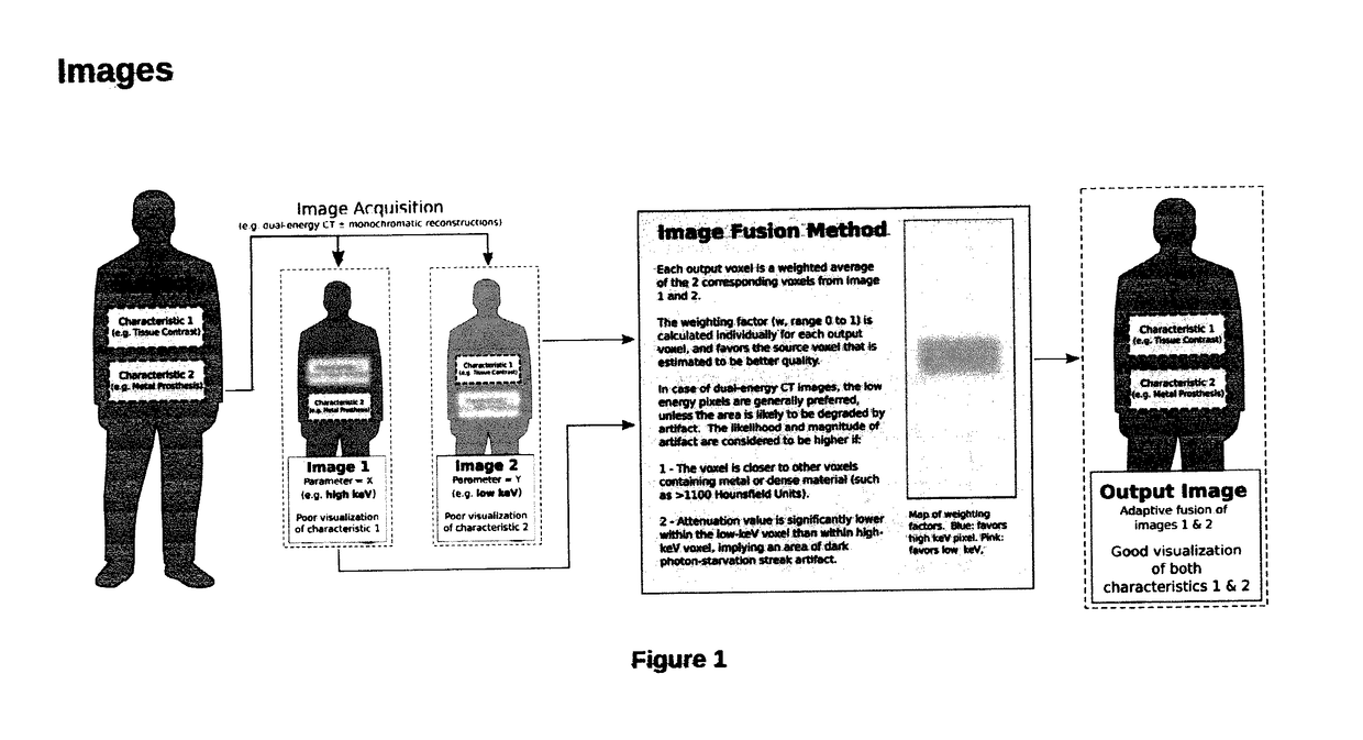 Method for Reduction of Artifacts and Preservation of Soft Tissue Contrast and Conspicuity of Iodinated Materials on Computed Tomography Images by means of Adaptive Fusion of Input Images Obtained from Dual-Energy CT Scans, and Use of differences in Voxel intensities between high and low-energy images in estimation of artifact magnitude