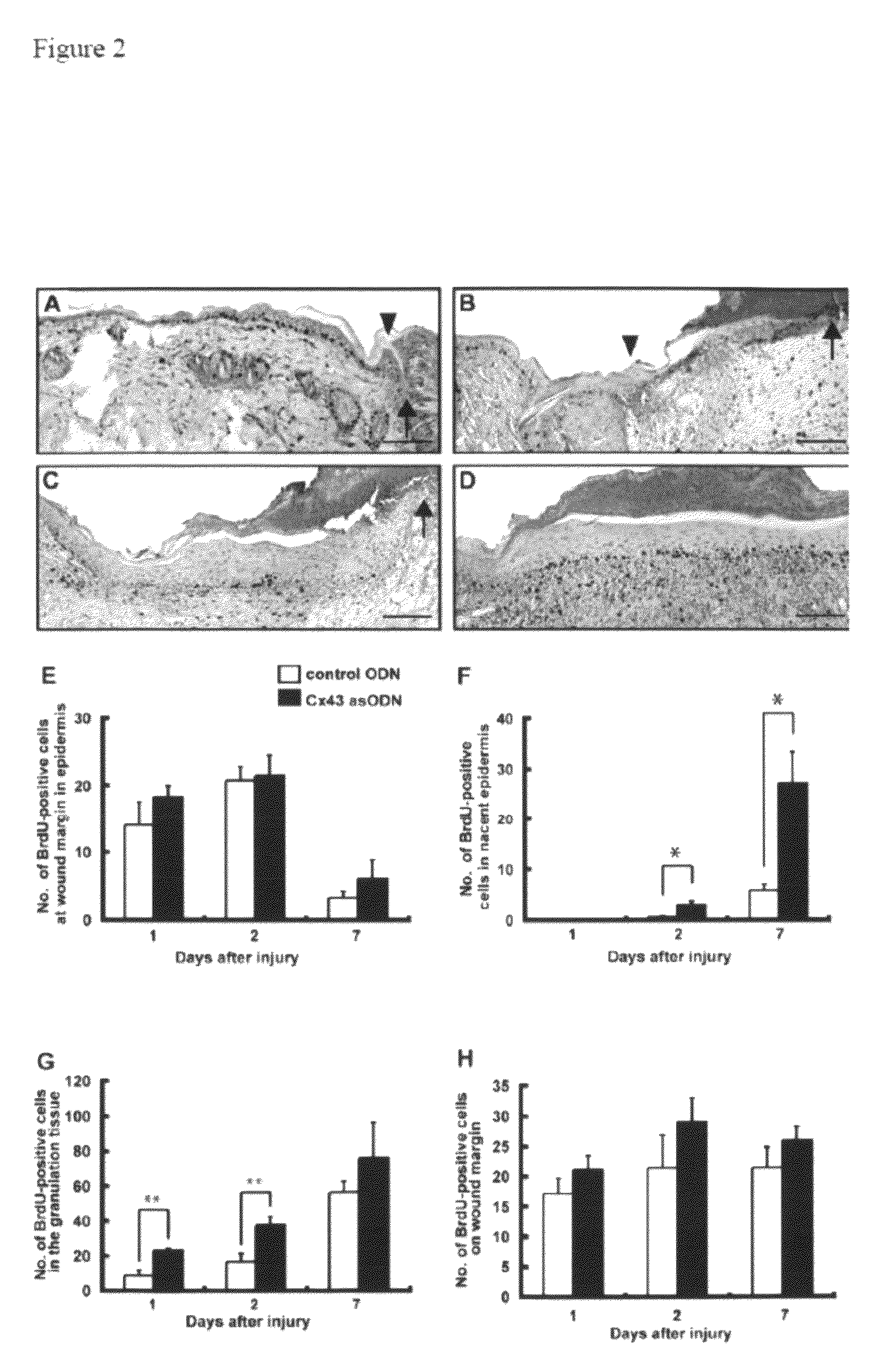 Methods and compositions for wound healing