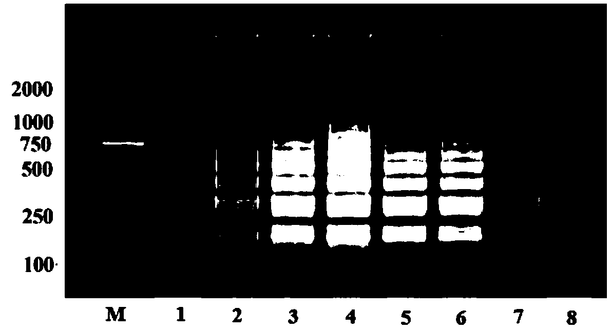 RT-LAMP based primer set and kit for detecting SFTSV