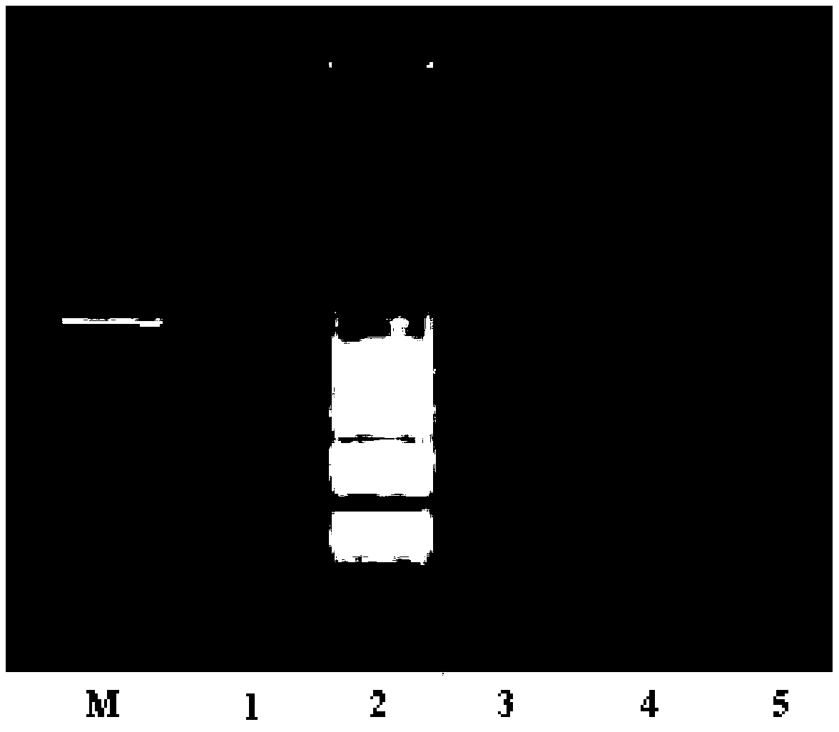 RT-LAMP based primer set and kit for detecting SFTSV