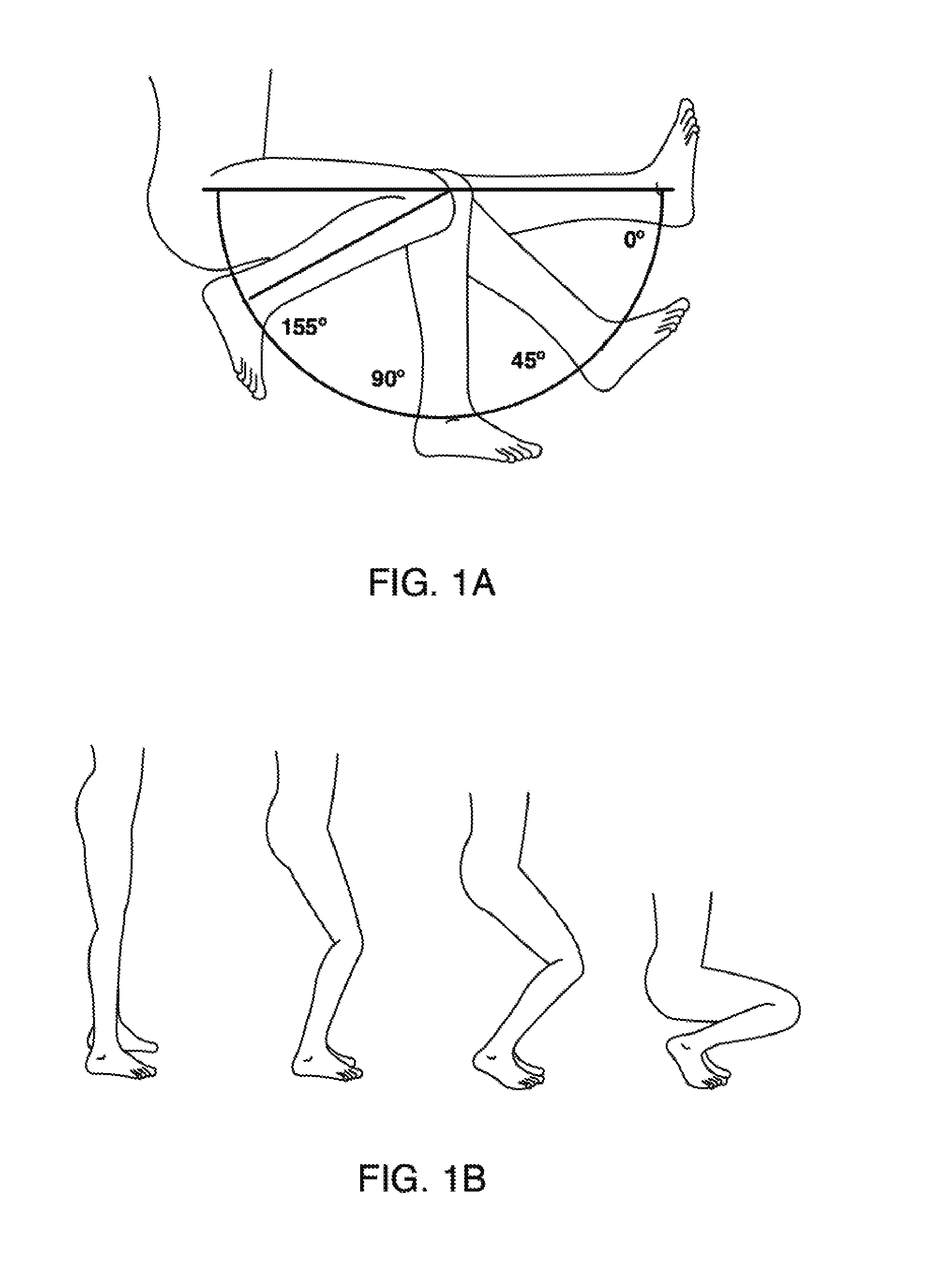 Systems and methods for providing lightweight prosthetic components