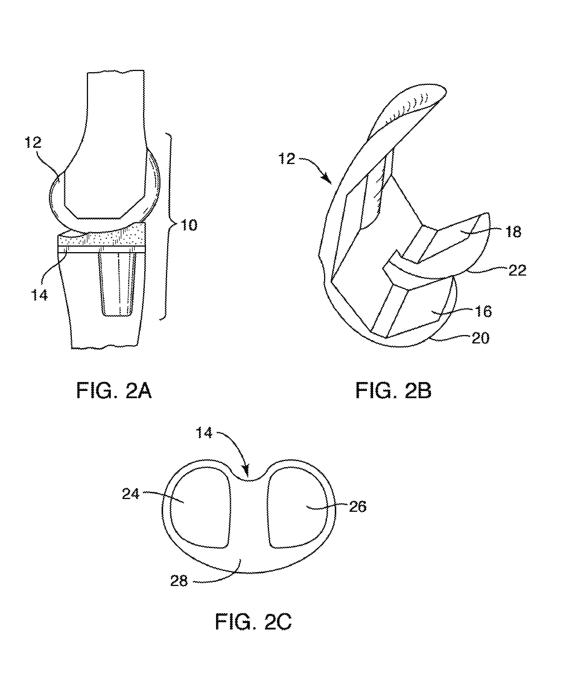 Systems and methods for providing lightweight prosthetic components