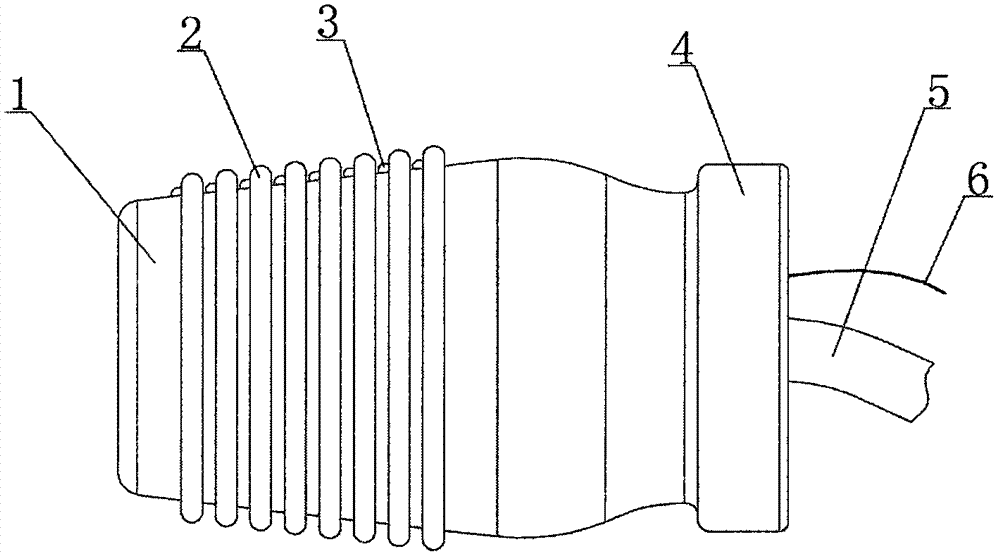 Endoscopic Esophageal Varice Ligation Device