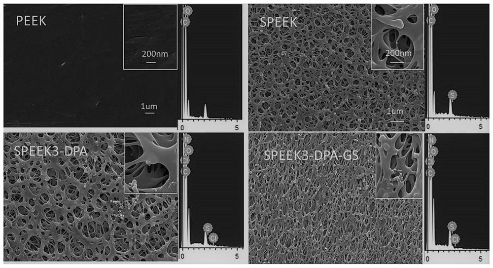 Polyether-ether-ketone three-dimensional porous and modified polydopamine/gentamicin for anti-bacteria and and anti-inflammation effects and promotion of osseointegration of implant