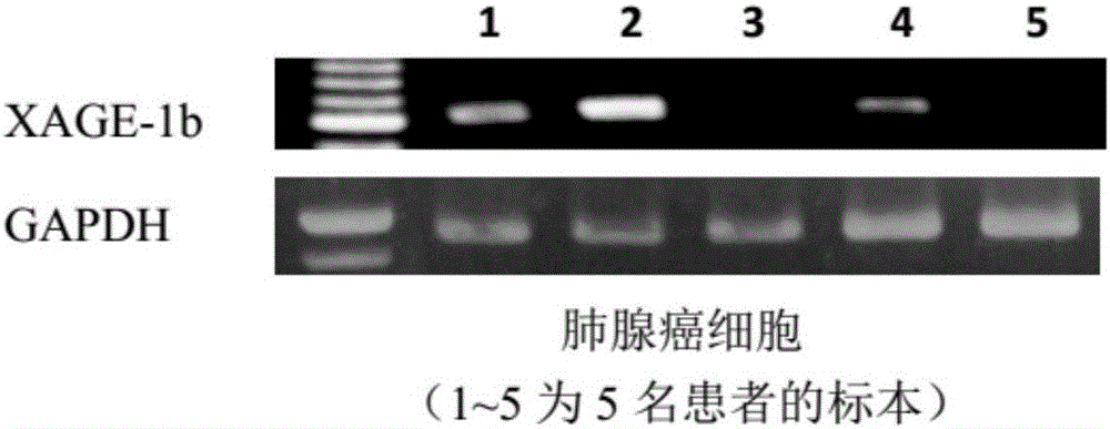 Tumor-associated antigen XAGE-1b short-peptide and application thereof