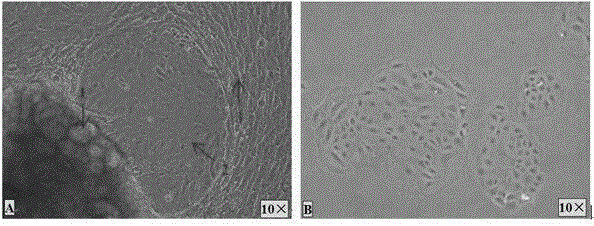 Cell in-vitro culture method for primary culture of bovine mammary epithelial cells