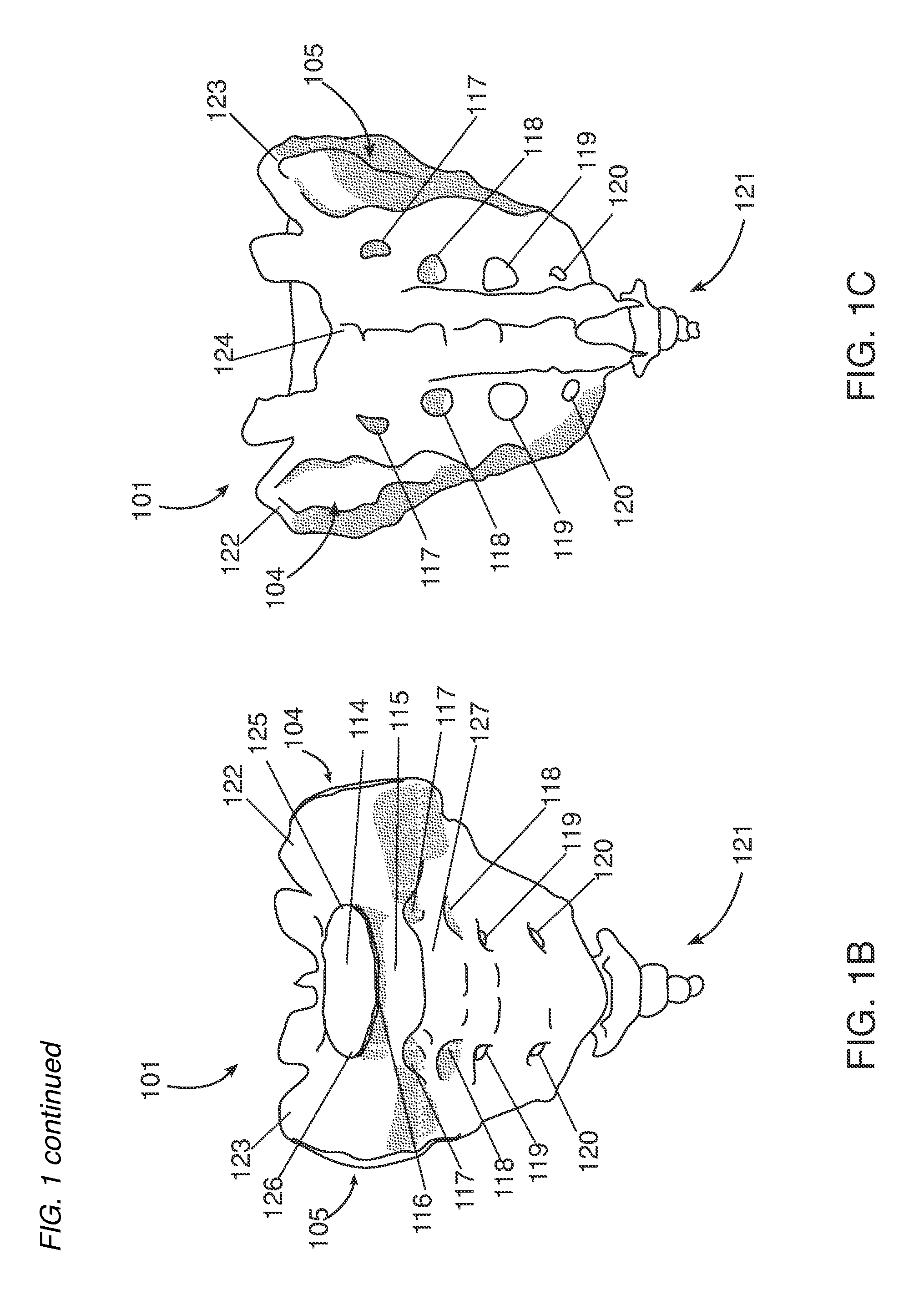 Minimally invasive approaches, methods and apparatuses to accomplish sacroiliac fusion