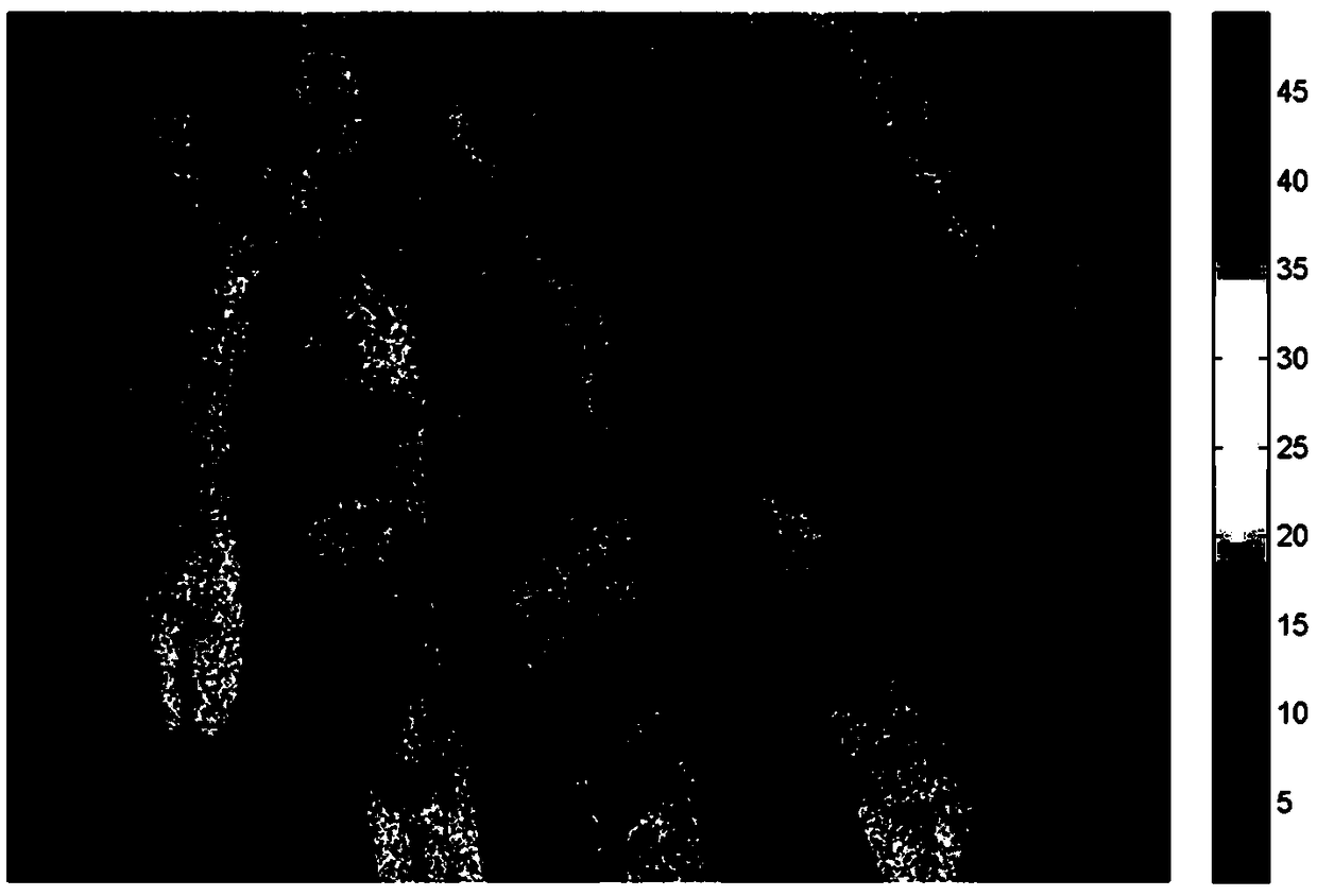 Laser speckle blood perfusion imaging method