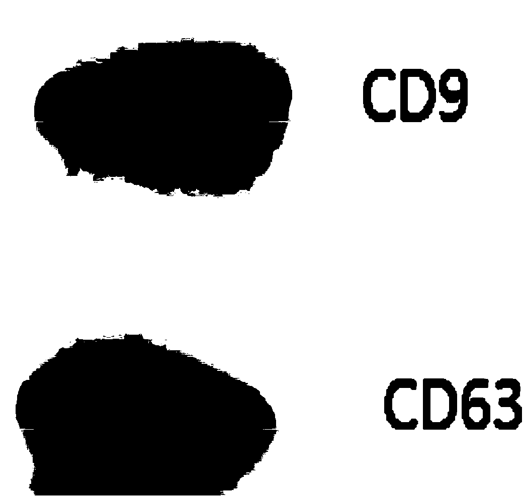 Exosome derived from human pluripotent stem cells, preparation based on exosome and use of exosome and preparation