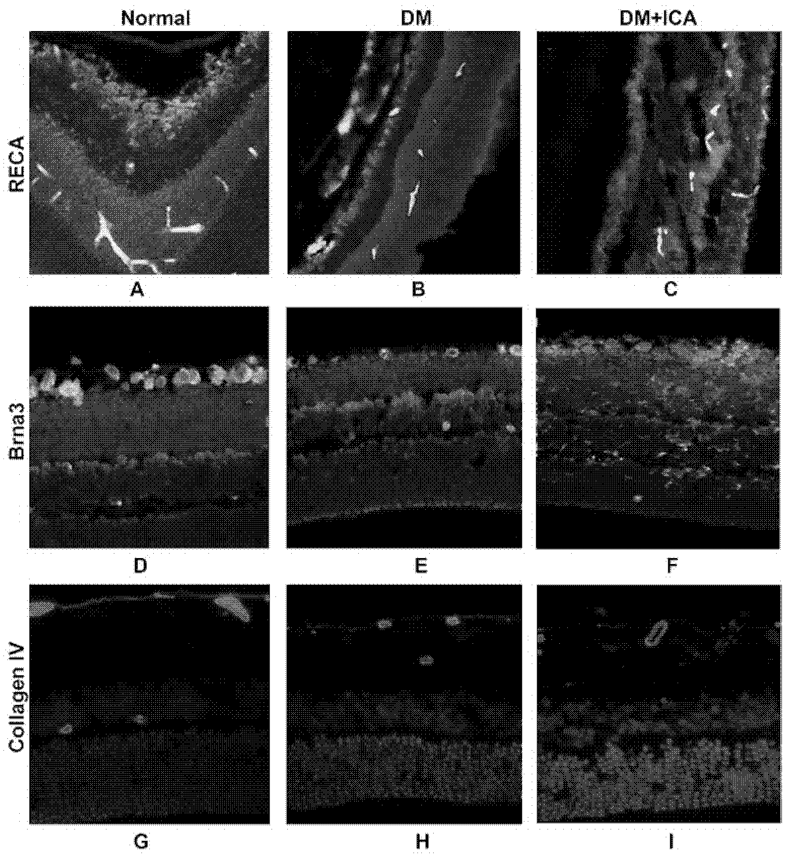 Application of icariin or icarisid II in preparation of medicine for preventing and curing diabetic retinopathy