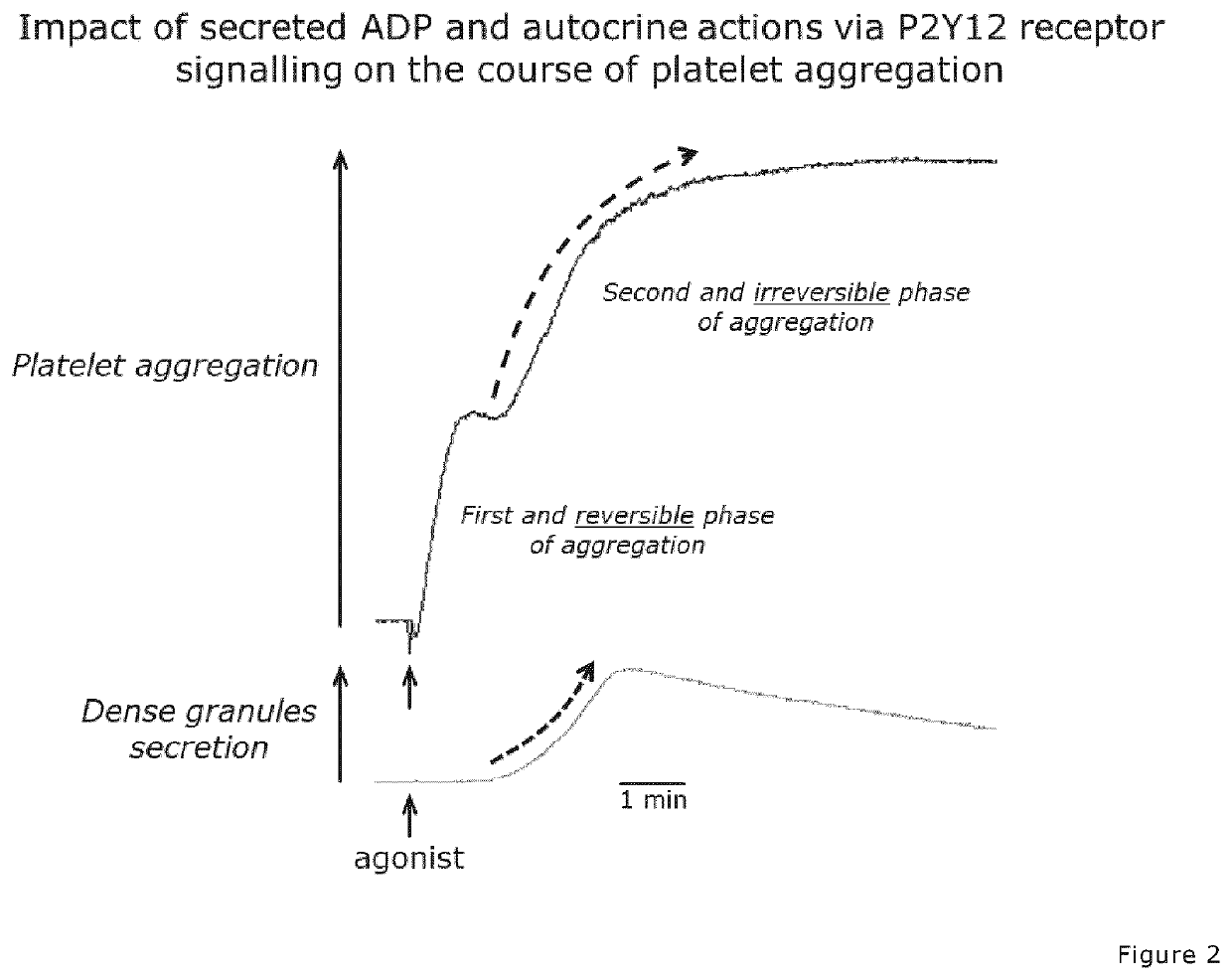 Treatment of patients under antiplatelet medication experiencing acute bleeding complications during/after surgery