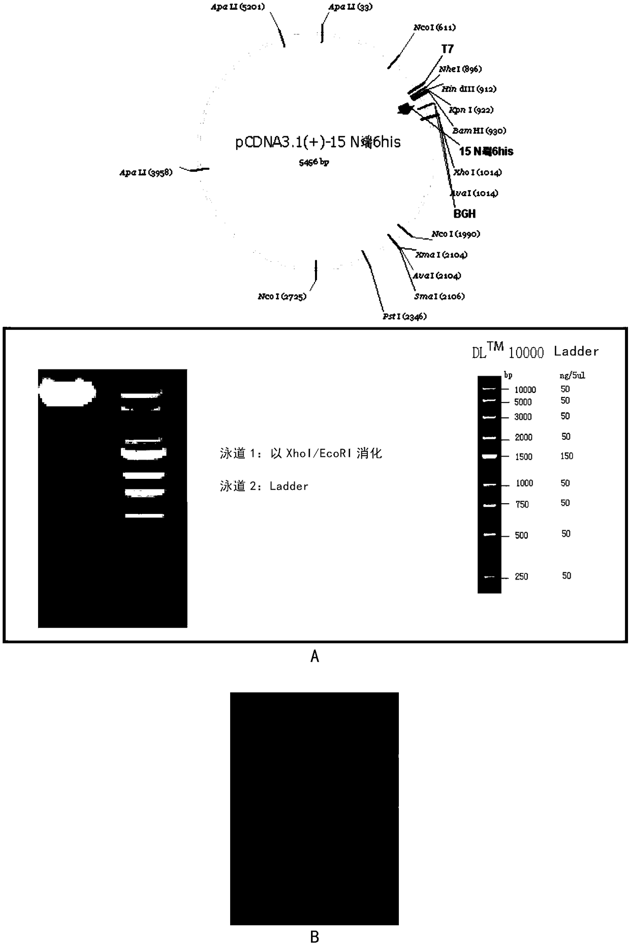 Application of short peptide to preparation of immunoregulation medicament