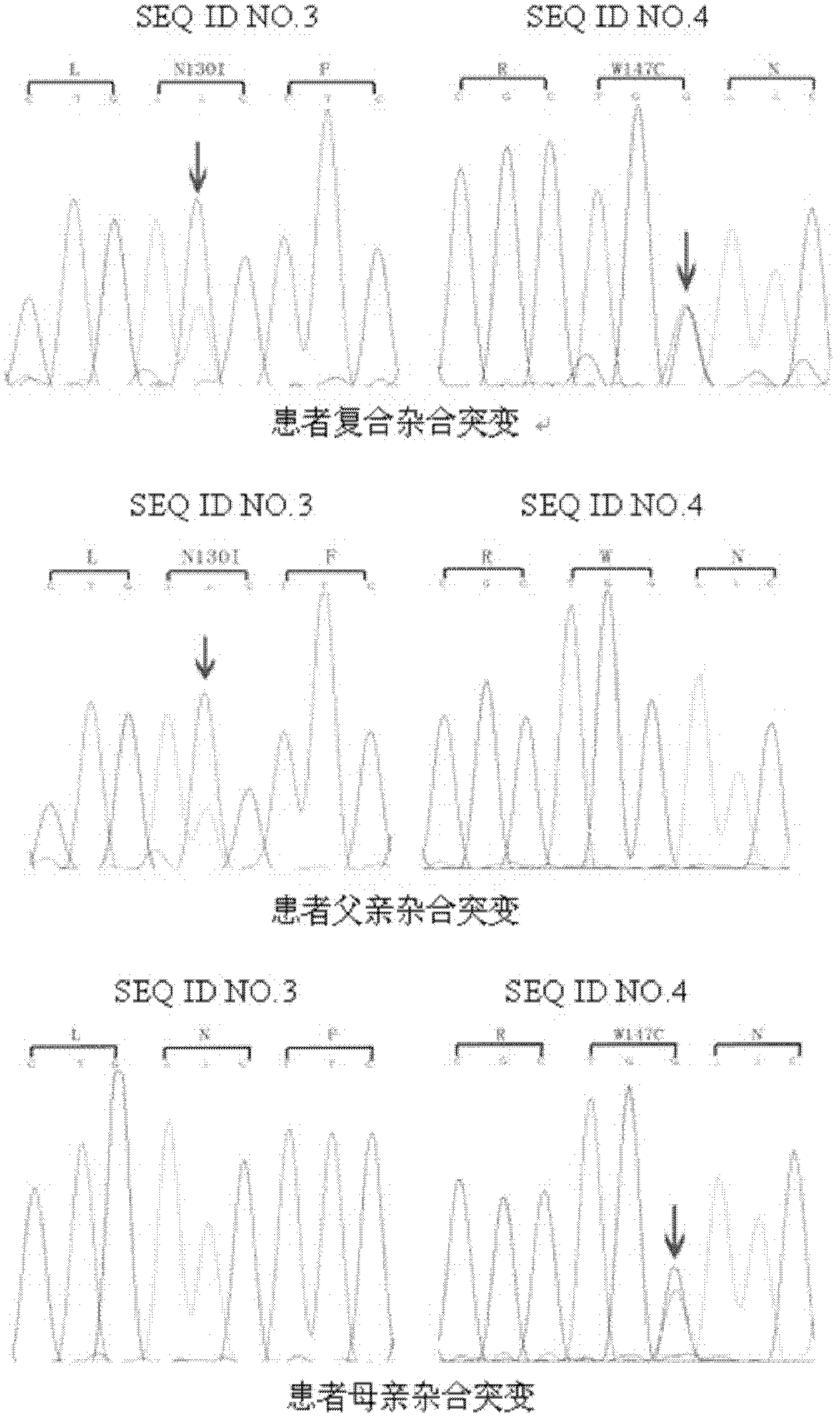 Related genes of autosomal recessive cerebellar ataxia