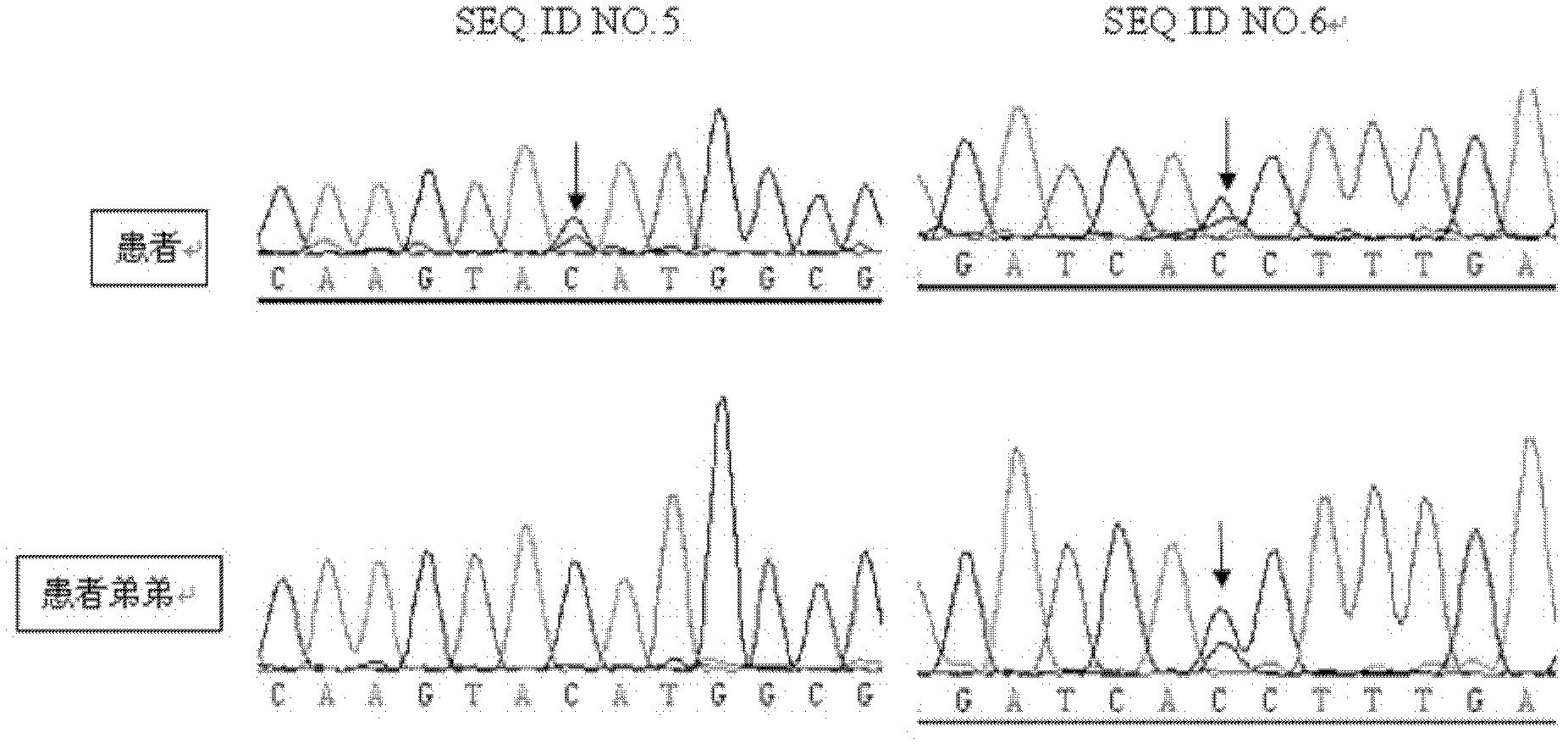 Related genes of autosomal recessive cerebellar ataxia