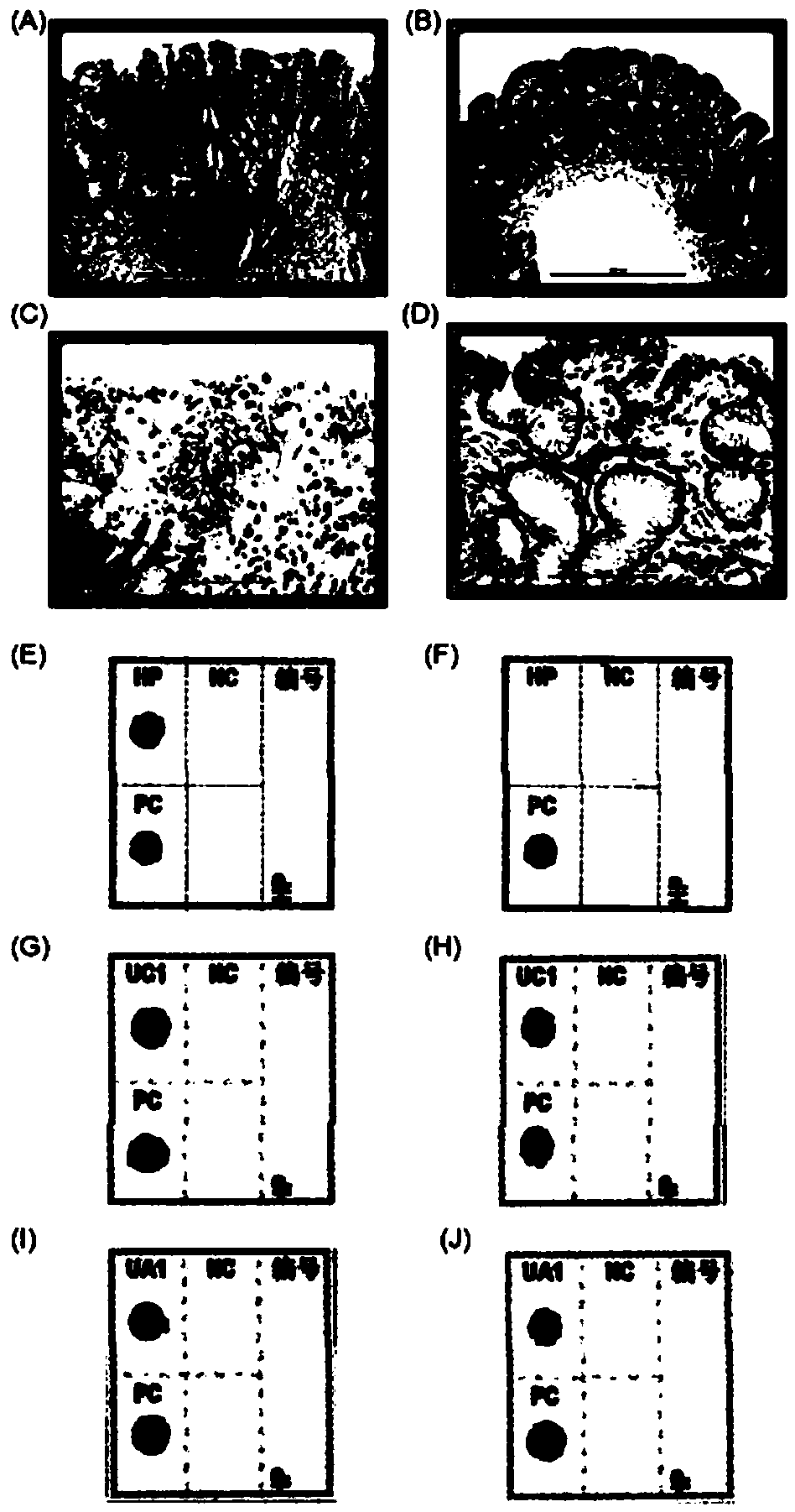 Helicobacter pylori specific molecular marker and detection kit