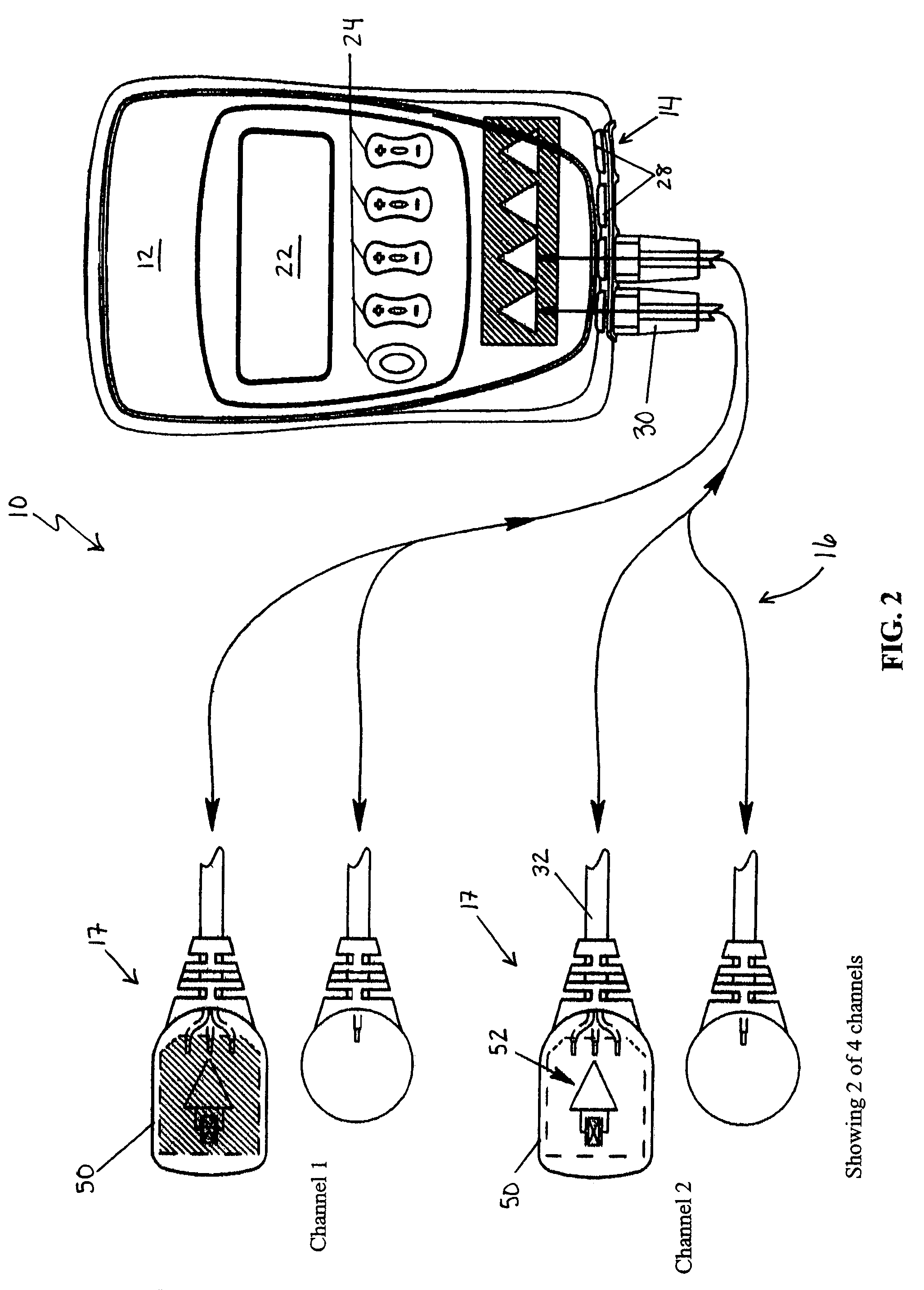 Automated adaptive muscle stimulation method and apparatus