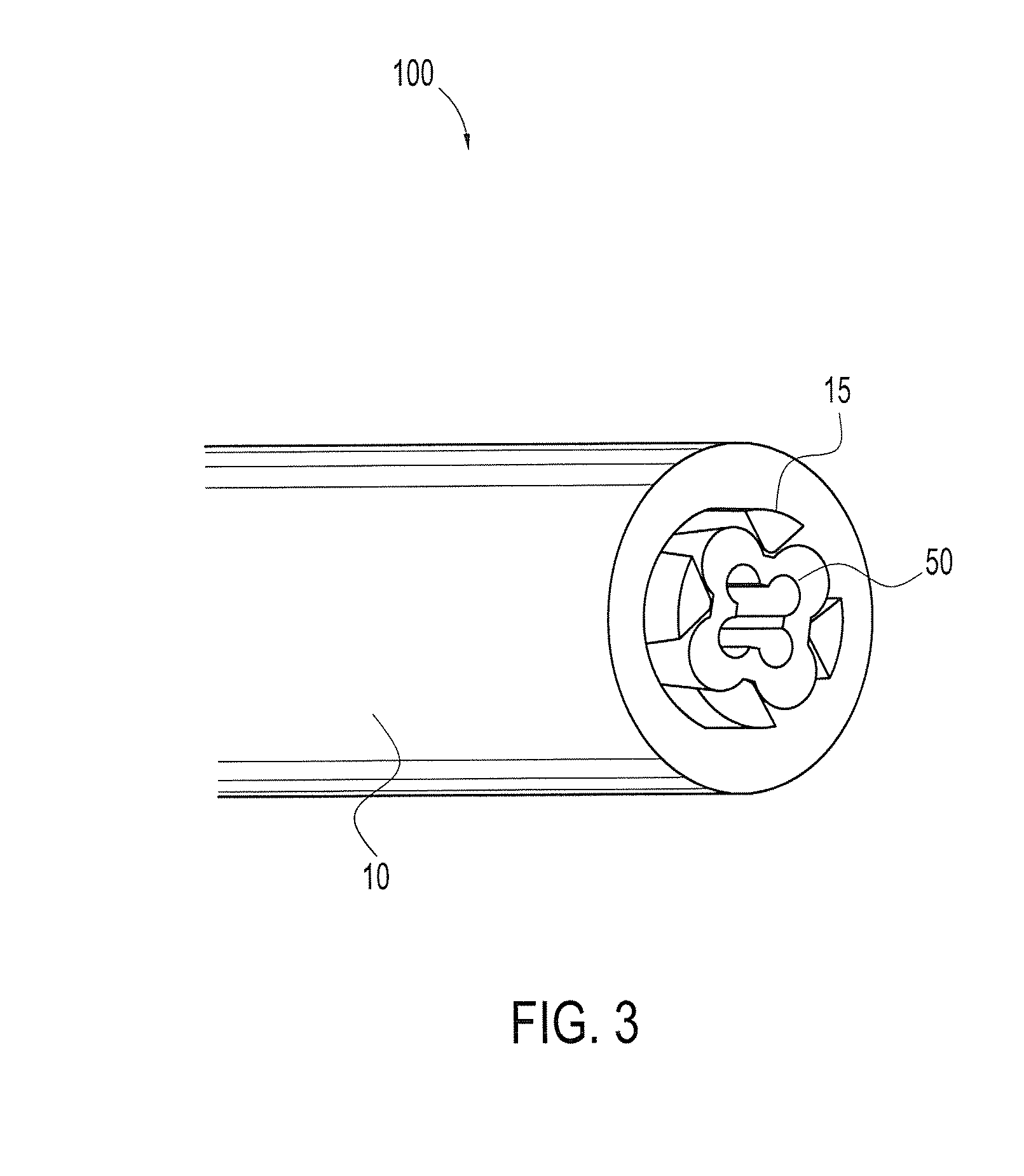 Methods of arthroscopic osteochondral resurfacing