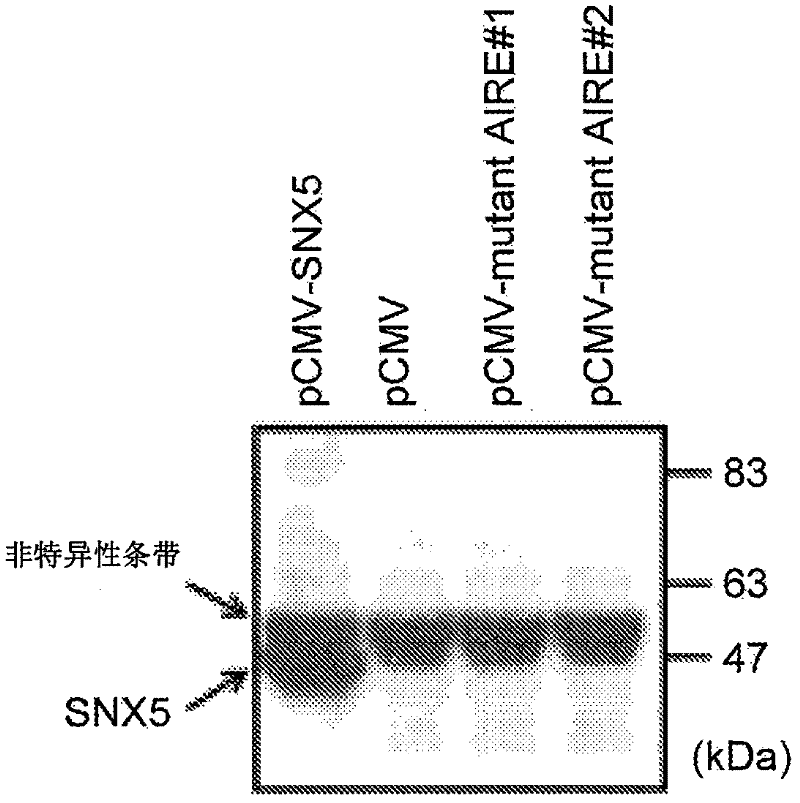 Tumor marker and use thereof