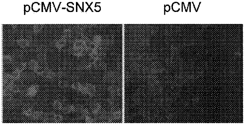 Tumor marker and use thereof