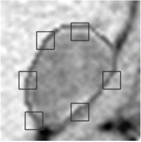 Method for segmenting adrenal tumor of medical CT (computed tomography) image based on sparse representation