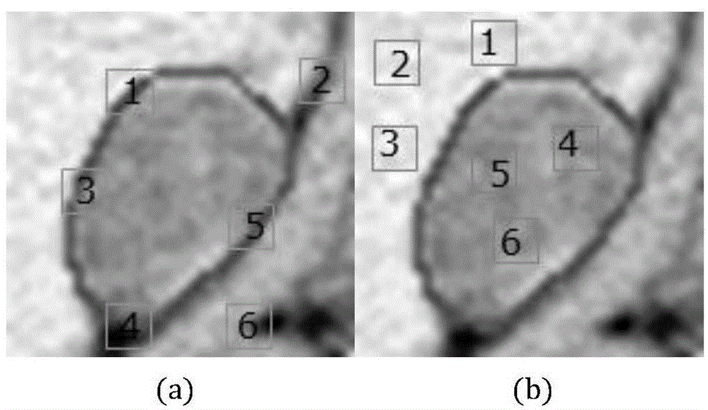 Method for segmenting adrenal tumor of medical CT (computed tomography) image based on sparse representation