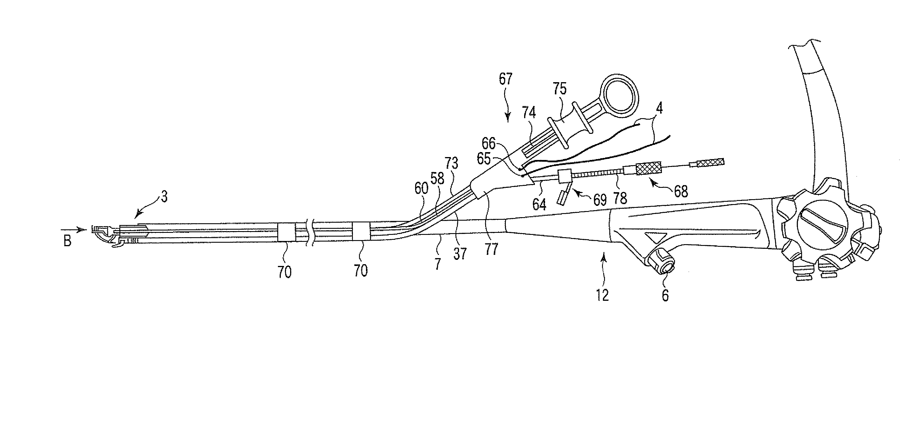 Endoscopic suturing system