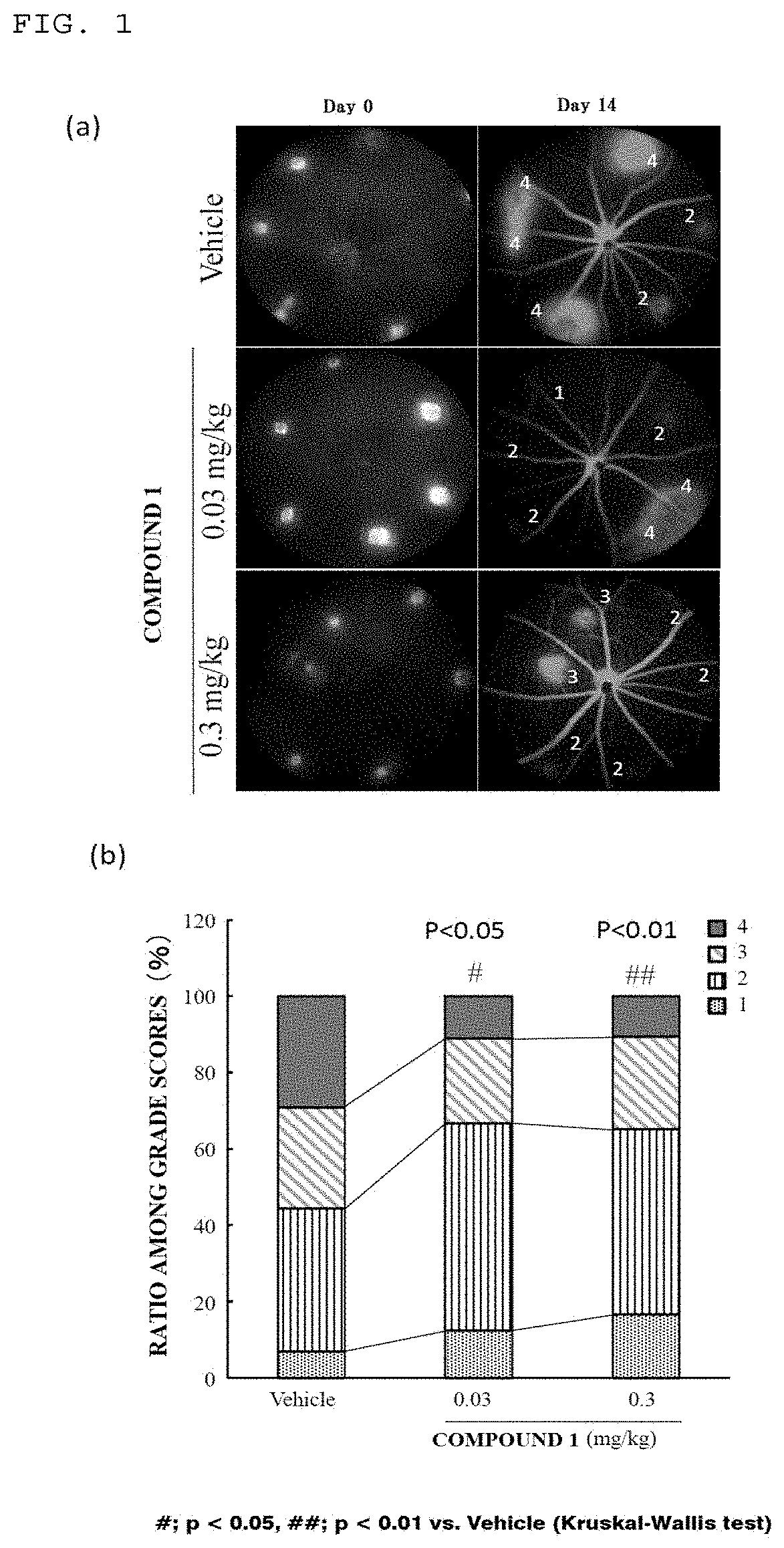 Medicine for preventing or treating ophthalmic disease associated with enhanced intraocular neovascularization and/or intraocular vascular permeability