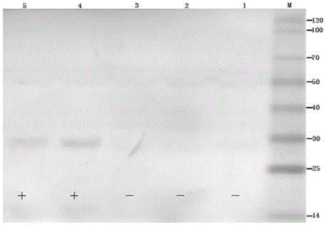 EF-Tu protein monoclonal antibody MAb of Brucella Melitensis and preparation method and application thereof