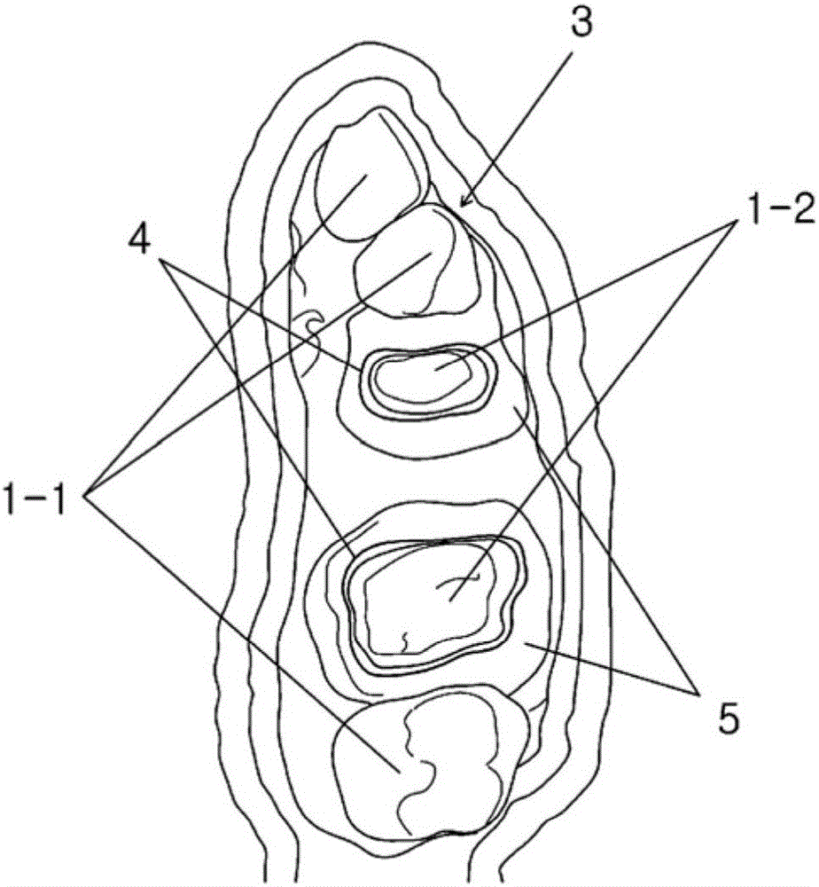 Method for manufacturing dental model