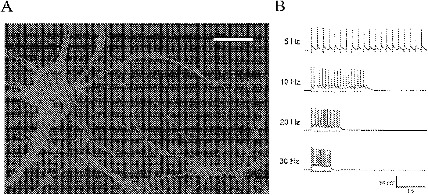 Vectors for delivery of light-sensitive proteins and methods of use