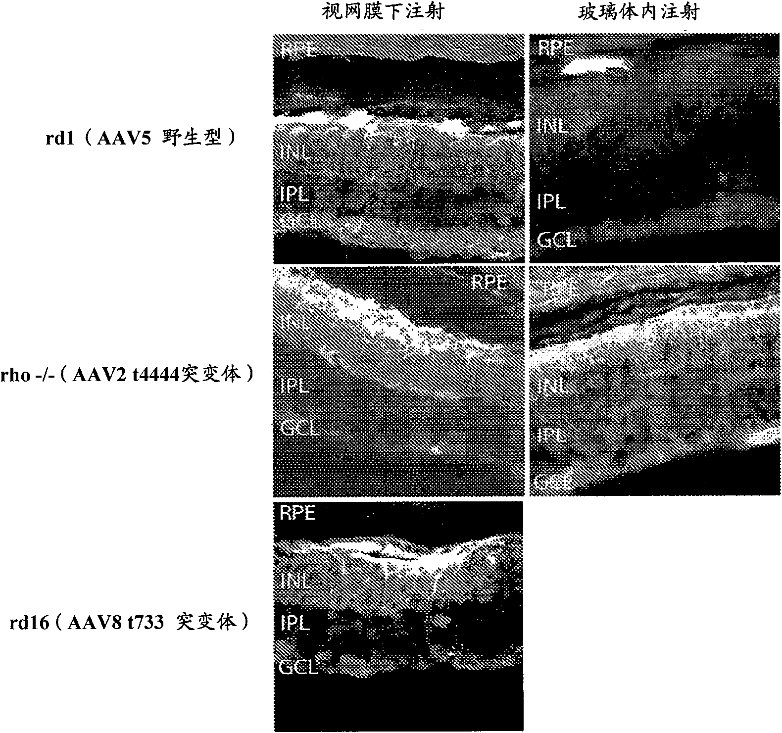 Vectors for delivery of light-sensitive proteins and methods of use