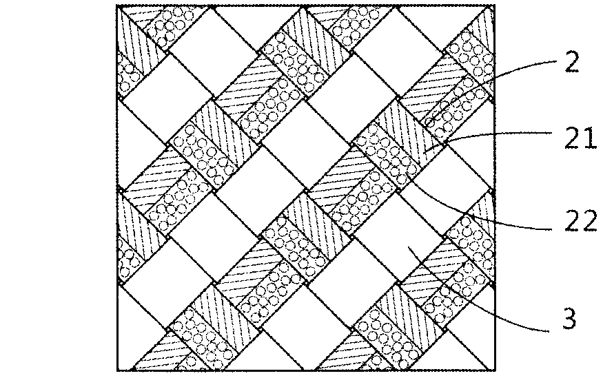 Textile multicomponent enhancement structure-gradually degradable ureteral stent tube and preparation method thereof