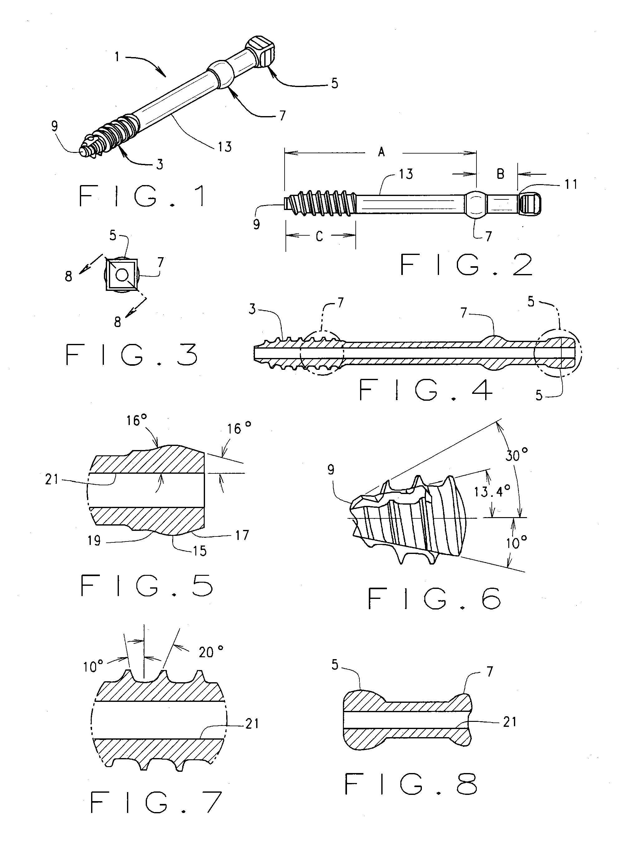 Minimal incision removable bone screw, driver, and method of use