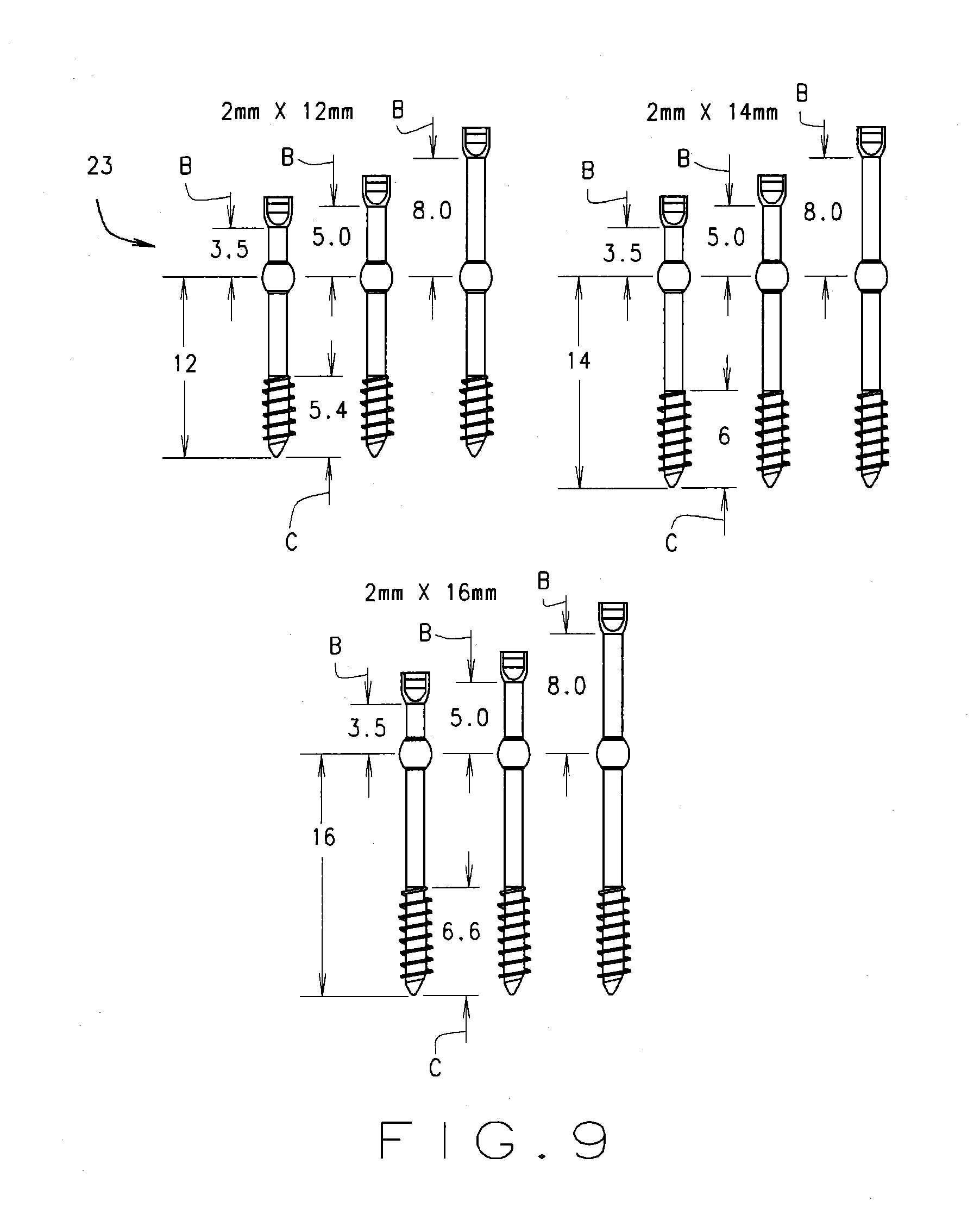 Minimal incision removable bone screw, driver, and method of use