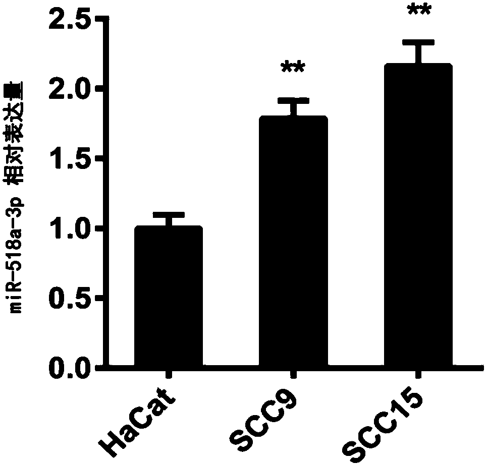 Application of miR-518a-3p in diagnosis of oral carcinoma