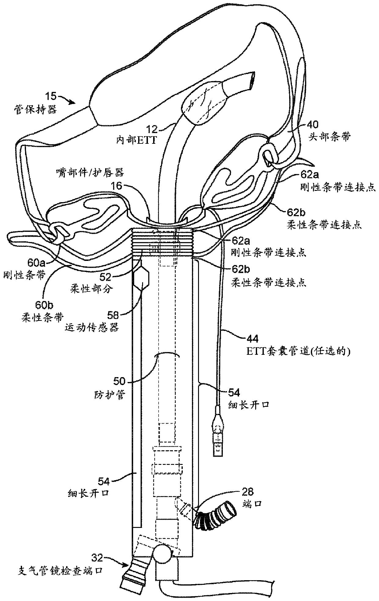 Endotracheal tube guard with optional holding system and optional sensor