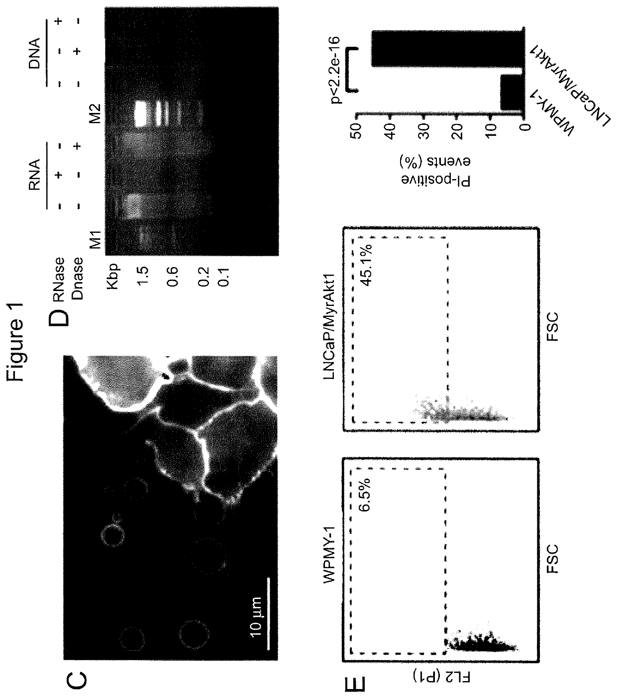 Palmitoyl Protein Biomarkers in Purified Extracellular Vesicles for Early Identification of Clinically Significant Prostate Cancer